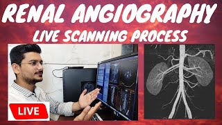 CT RENAL ANGIOGRAPHY LIVE SCAN  Live ct scan of renalabdominal Angiography radiologytechnologist [upl. by Annej]