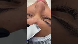 Remove ACNE FAST With These Treatment Secrets dermatologia pimple blackheadsolutions [upl. by Ritchie]