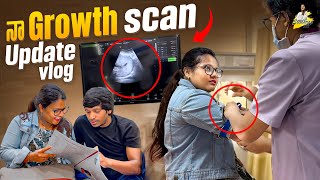 నా Growth Scan Update Vlog  Yadammaraju  StellaRaj 777 [upl. by Abeh517]