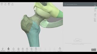 Femur bone anatomy labeled  3D Anatomy [upl. by Hagerman924]