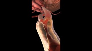 Carotid Arteries Under Attack How Plaque Leads to Stroke medicine anatomy shorts [upl. by Atinnod506]