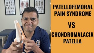 Chondromalacia Patella vs Patellofemoral Pain Syndrome [upl. by Trik]