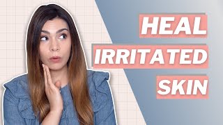 How I Fixed my Irritated Skin Quickly  Tips and Routine [upl. by Halak723]