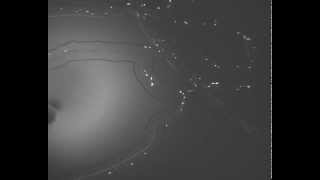 Leukocyte Interaction with Endothelium in SynVivo Microvascular Network [upl. by Alyson193]