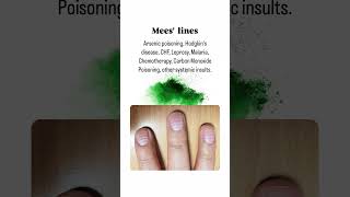 Common Nail Diseases You Should Know About NailHealthNailCareFungalInfectionNailPsoriasis [upl. by Ycul]