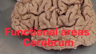 Functional areas of brain neuroanatomy cerebrum anatomy functional areas of cerebrum [upl. by William38]