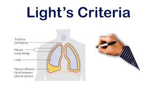 Pleural Effusion Lights Criteria  USMLE STEP COMLEX NCLEX [upl. by Ennaed]