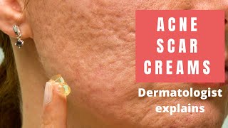 Acne Scar Creams  Dermatologist Reviews [upl. by Titus873]