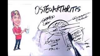 Osteoarthritis Explained Simply [upl. by Anitsyrk]