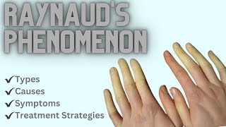 Raynauds Phenomenon Types Causes Symptoms and Treatment Strategies [upl. by Penthea]