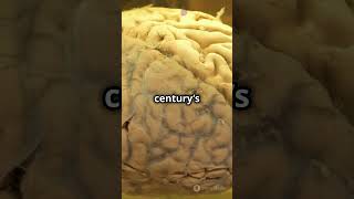 Albert Einstein stolen brain facts einstein earthhistory shorts einsteinbrain oppenheimer [upl. by Mart]