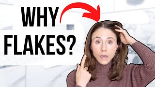 Why Your Scalp Is Flaky The Difference Between Dryness And Dandruff Explained [upl. by Roley509]