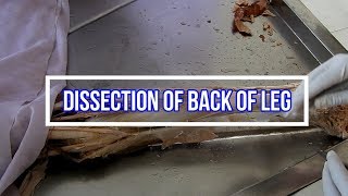 Dissection of Back of Leg [upl. by Hannasus]