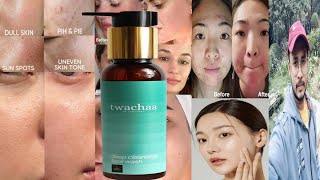 Twachaa Deep Cleansing Face Wash  Honest Review [upl. by Nivri]