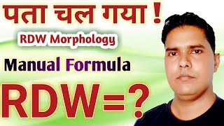 RDW blood test hindi  RDW manual formul  RDW morphology [upl. by Dinse58]