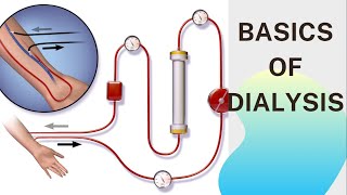 Basic concept of Dialysis Machine  Fresenius 4008S  Dialyzer amp Dialysate Function [upl. by Eannej]