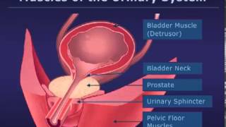 Botox Injections for Bladder Conditions [upl. by Corbie691]