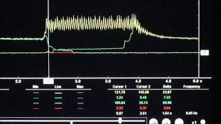 Aisian AW TCM Learn Procedure [upl. by Arramas]