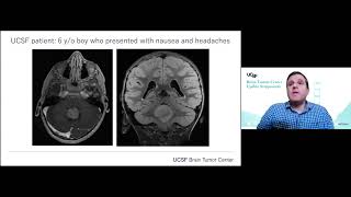 Brain Tumor GenomicsEpigenomics  David A Solomon MD PhD [upl. by Carthy410]