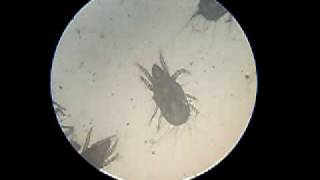 mites  acarids  microscope video  arachnid [upl. by Wes]