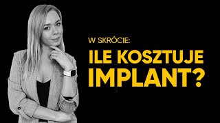 ILE KOSZTUJĄ IMPLANTY ZĘBÓW [upl. by Eniledgam]