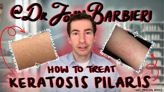 How to treat small pimple bumps on the arms – Dermatologist explains keratosis pilaris [upl. by Latsyrk]