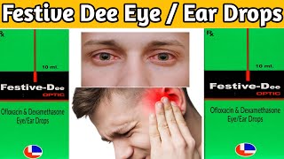 festive dee  festive dee optic eyeear drops ofloxacin dexamethasone eye ear drops [upl. by Bobbye]