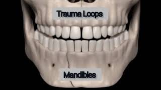 Trauma Loops — Mandibles [upl. by Zavala]