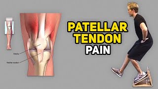 3 Exercises for Jumper’s Knee Patellar Tendinopathy [upl. by Fleisher]