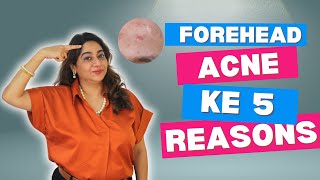 Forehead Acne ke 5 Reasons  By Dr Parul  Skincare Dermatologist  Haircare Specialist [upl. by Ecinahs599]