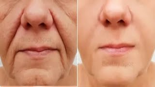 Antiaging remedy remove wrinkles from face look 10 years younger [upl. by Beker]