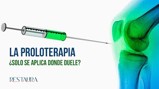 La proloterapia ¿Solo se aplica donde duele [upl. by Ynettirb]