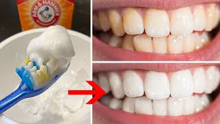 Teeth Whitening Home Remedies amp DIY Hacks Fast Natural amp Affordable White Teeth [upl. by Miru]