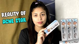 Acnestar Gel review  How to Get rid of Acne  Noni Roga [upl. by Emerej]