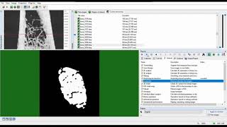 Automated segmentation of trabecular and cortical bone  CTAn  MicroCT [upl. by Eltsryk689]