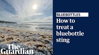 What to do if you get stung by a bluebottle explained by a lifesaver [upl. by Iiette]