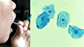 Cheek Epithelial Cell Practical Experiment [upl. by Nivram]