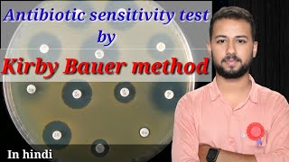 Antibiotic sensitivity test by disc diffusion method  kirby bauer disk diffusion method in hindi [upl. by Neltiak267]