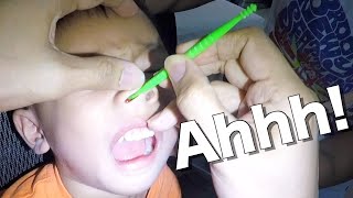 Removing Something Stuck Inside Boys Nose  Its STUCK [upl. by Wareing]