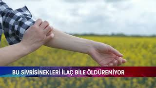 BU SİVRİSİNEKLERİ İLAÇ BİLE ÖLDÜREMİYOR [upl. by Edlihtam]