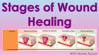 Stages of Wound Healing [upl. by Onitnevuj225]