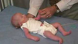 neurology exam newbornabnormal Primitive Reflexes  Moro [upl. by Janna]