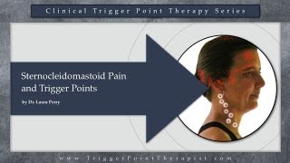 Sternocleidomastoid SCM Pain and Trigger Points [upl. by Llemej]