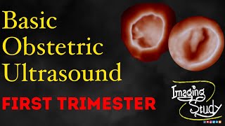 Basic Obstetric Ultrasound First Trimester Pregnancy [upl. by Nnylsaj]