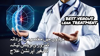 Discover the Desired Solution Best Venous Leak Treatment in Pakistan [upl. by Bashuk]