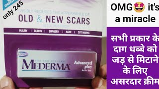 Medarma Cream Review and Demo  Best Cream for Scar  how to remove acne scar acne scar treatment [upl. by Gawain107]