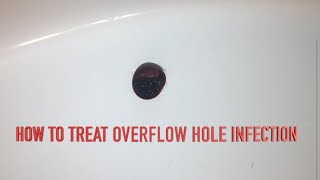 How to Treat Overflow Hole Infection [upl. by Zennie]