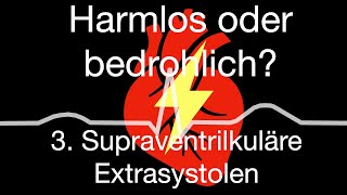 Herzrhythmusstörungen zwischen harmlos oder bedrohlich 3 supraventrikuläre Extraschläge [upl. by Laurita]