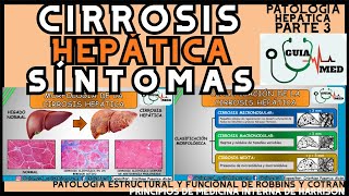 CIRROSIS HEPÁTICA SÍNTOMAS  GuiaMed [upl. by Aeila224]