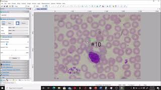 Conducting a Differential WBC Count with Human Blood [upl. by Judenberg]